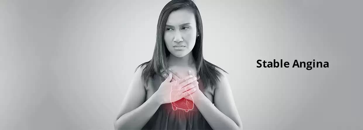 Know Everything About Stable Angina