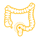 Rectal  Cancer