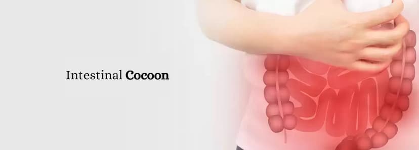 Case - Intestinal Cocoon Case Report