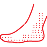 Vasculitis