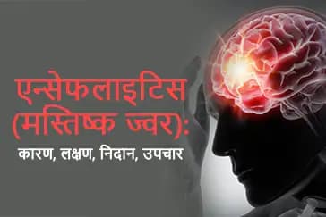 इन्सेफेलाइटिस के कारण, लक्षण, उपचार