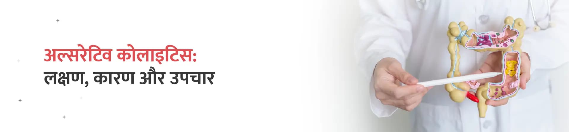 अल्सरेटिव कोलाइटिस: लक्षण, कारण और उपचार