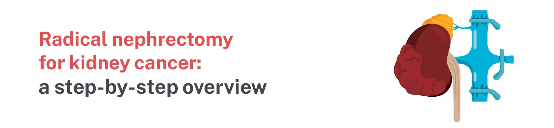 Radical nephrectomy for kidney cancer: a step-by-step overview