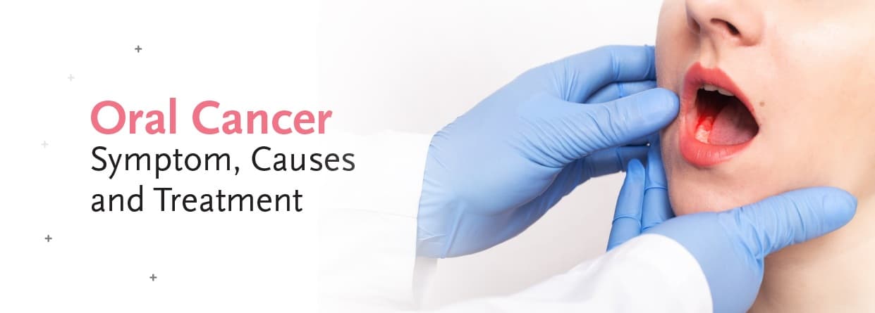 Oral Cancer: Symptom, Causes and Treatment