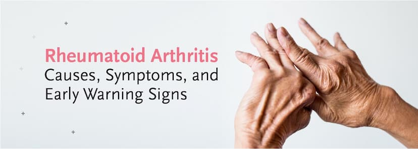 Rheumatoid Arthritis: Causes, Symptoms, and Early Warning Signs