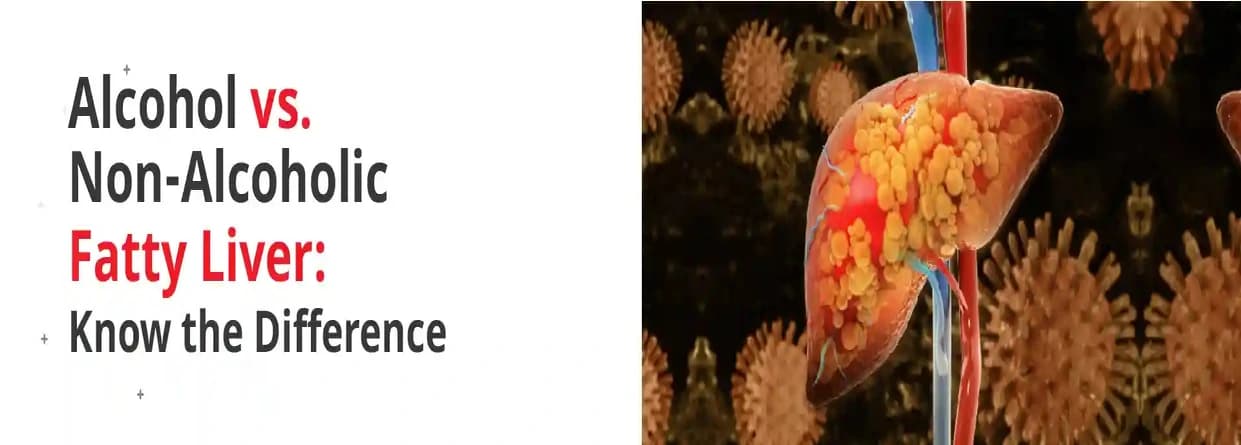 Alcohol vs. Non-Alcoholic Fatty Liver: Know the Difference