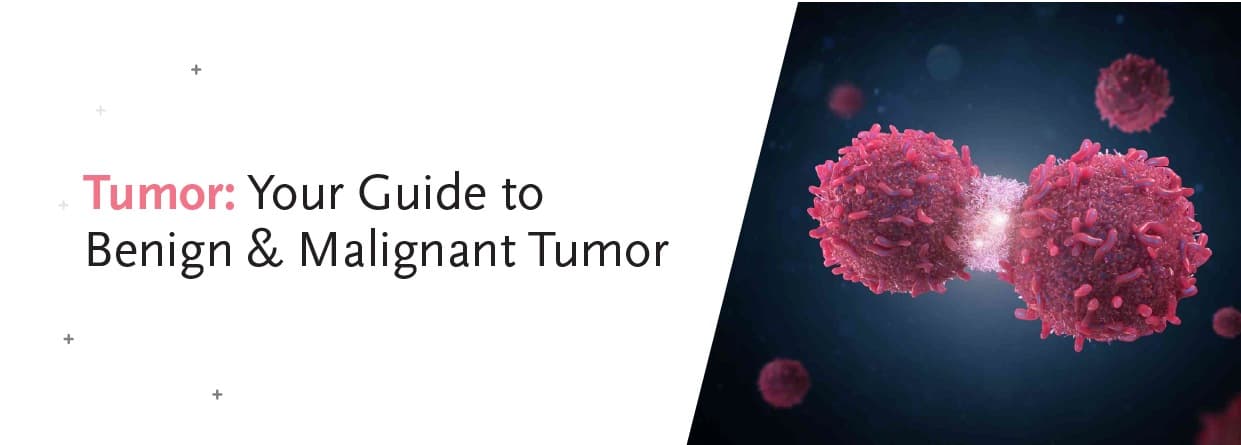 Tumor: Your Guide to Benign & Malignant Tumor