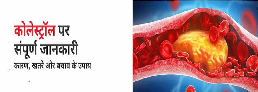 कोलेस्ट्रॉल पर संपूर्ण जानकारी-  कारण, खतरे और बचाव के उपाय