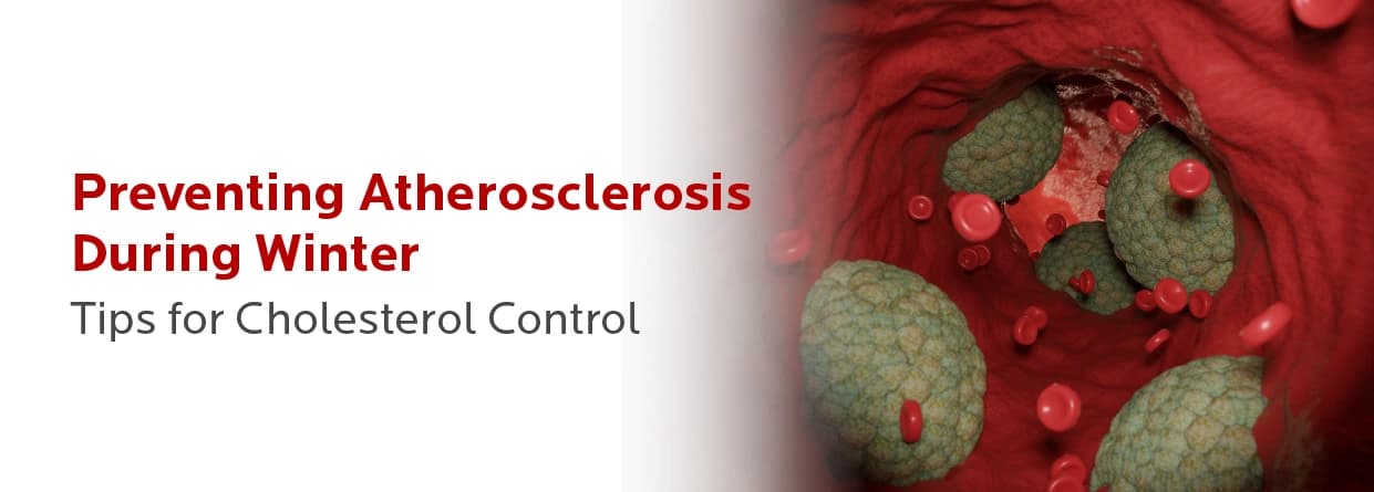 Preventing Atherosclerosis During Winter: Tips for Cholesterol Control