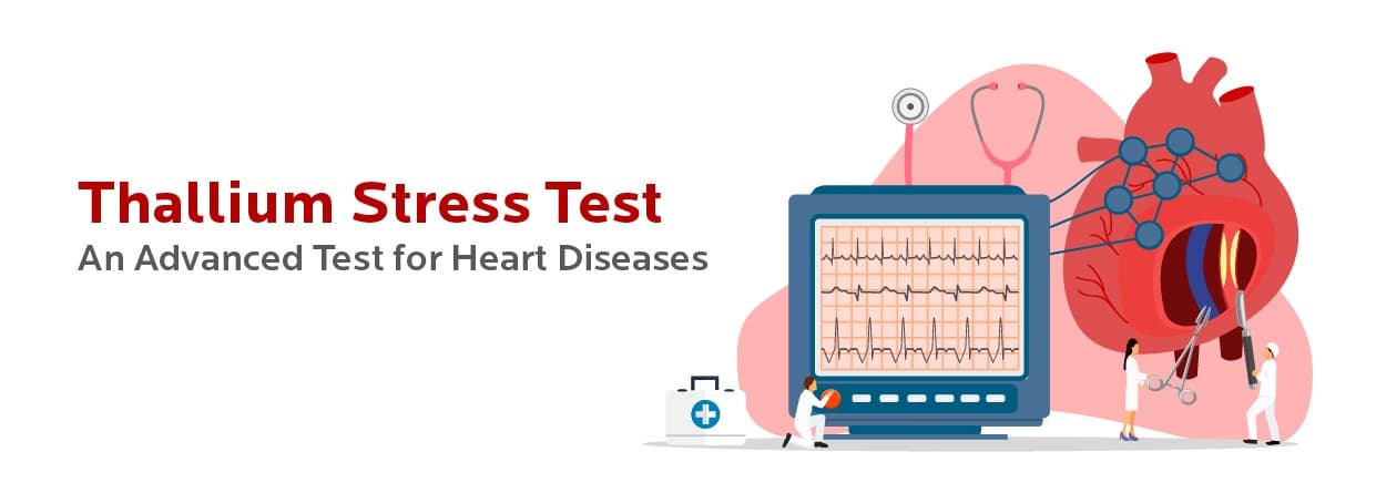 Thallium Stress Test: An Advanced Test for Heart Diseases