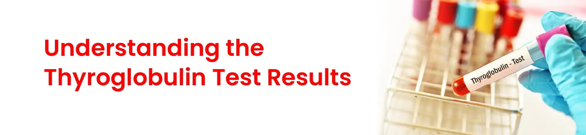 Understanding the Thyroglobulin Test Results