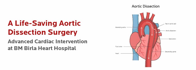 A Life-Saving Aortic Dissection Surgery Advanced Cardiac Intervention