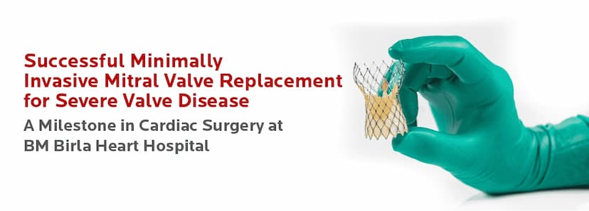 Minimally Invasive Mitral Valve  Replacement for Severe Valve Disease