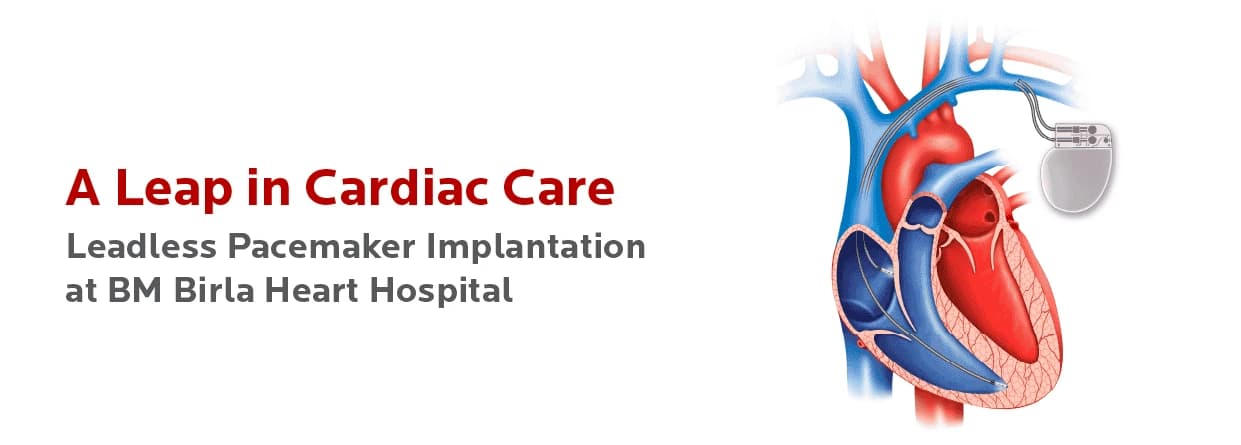 A Leap in Cardiac Care- Leadless Pacemaker Implantation
