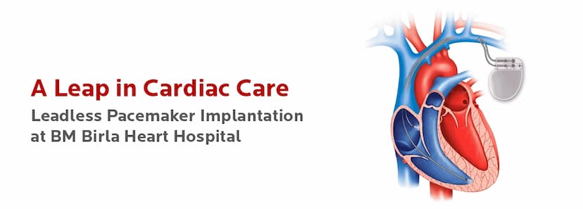 A Leap in Cardiac Care- Leadless Pacemaker Implantation