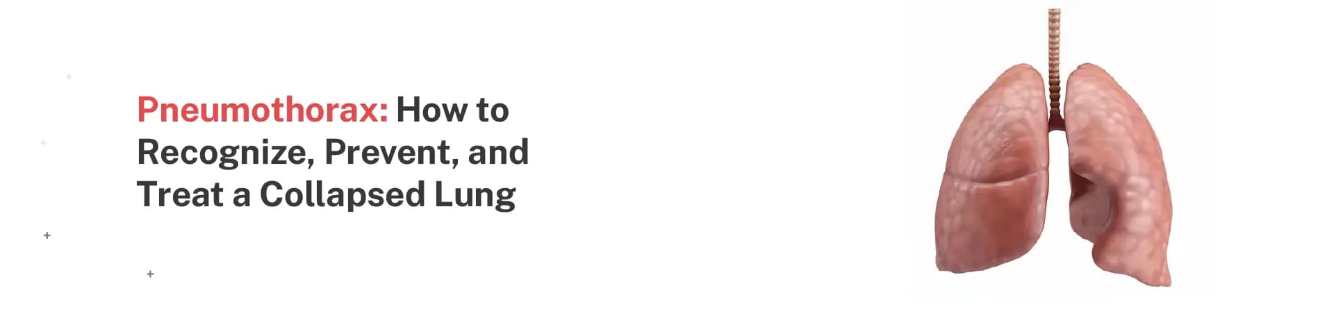 Pneumothorax: How to Recognize, Prevent, and Treat a Collapsed Lung