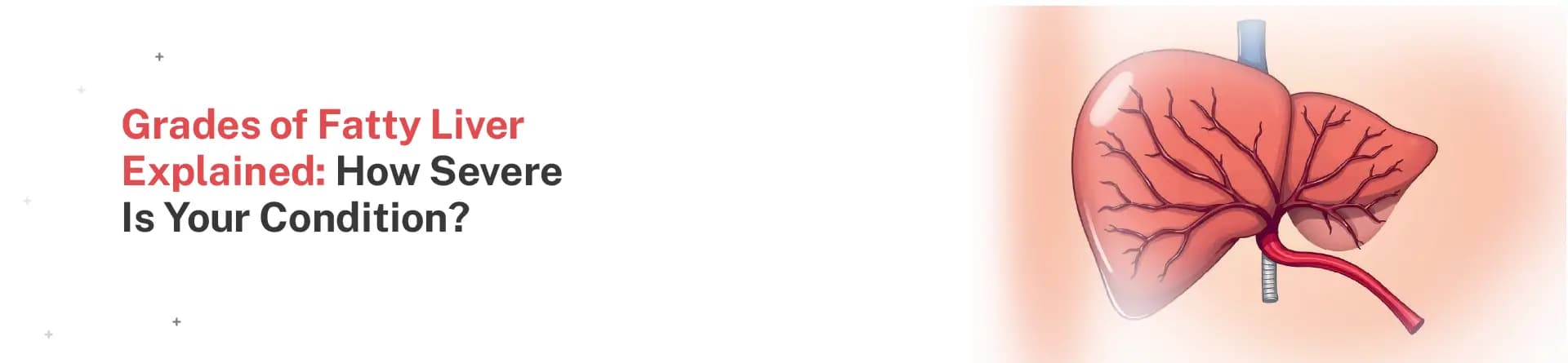 Grades of Fatty Liver Explained: How Severe Is Your Condition?