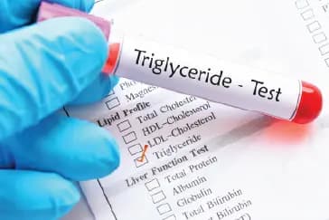 How Sugar and Alcohol Spike Your Triglycerides Without You Knowing