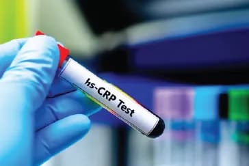hs-CRP Test: The Inflammation Marker That Predicts Heart & Cancer Risk