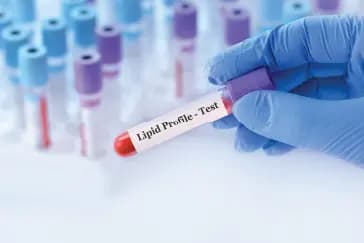 लिपिड प्रोफाइल क्या है? कोलेस्ट्रॉल और ट्राइग्लिसराइड्स को जानें