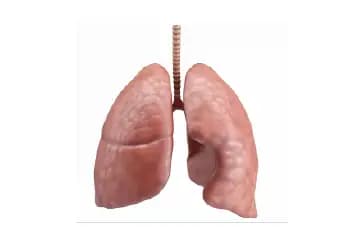 Pneumothorax: How to Recognize, Prevent, and Treat a Collapsed Lung