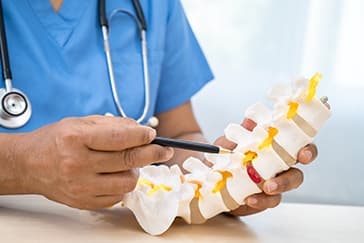 Slip Disc: Surgery or Physiotherapy – What’s the Right Choice?