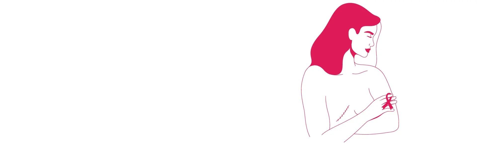 Mastectomy