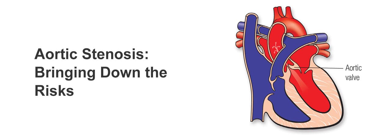 Aortic Stenosis: Bringing Down the Risks