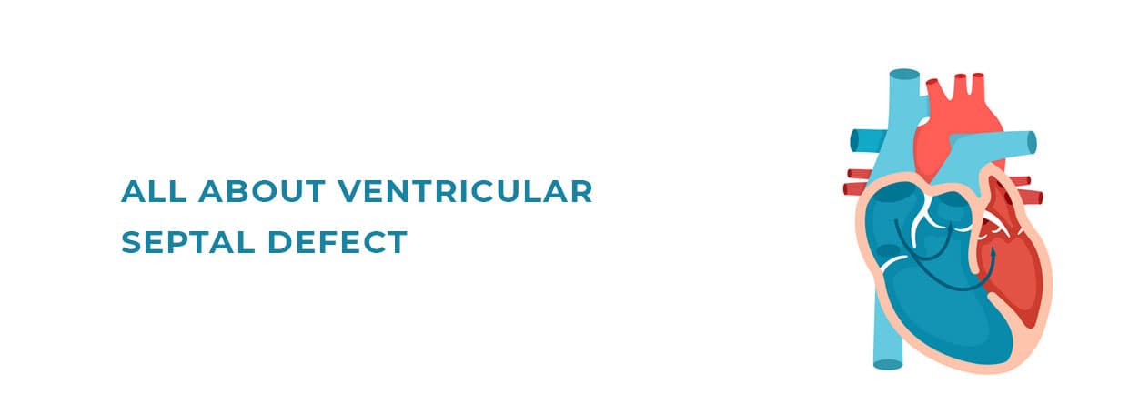 All About Ventricular Septal Defect
