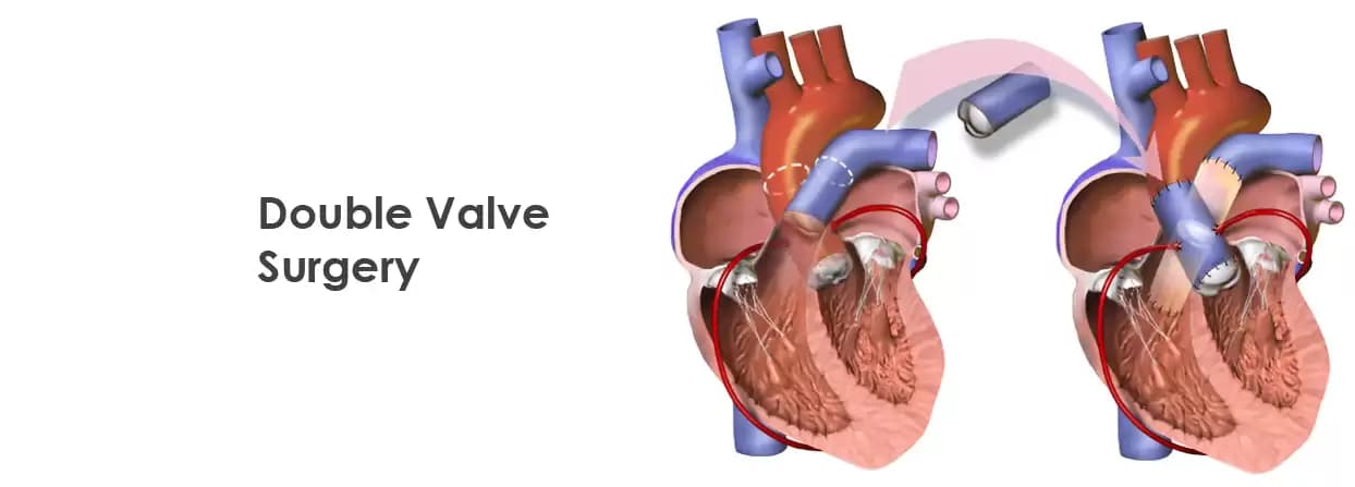 Could Changes in Your Skin be a Sign of Heart Disease?