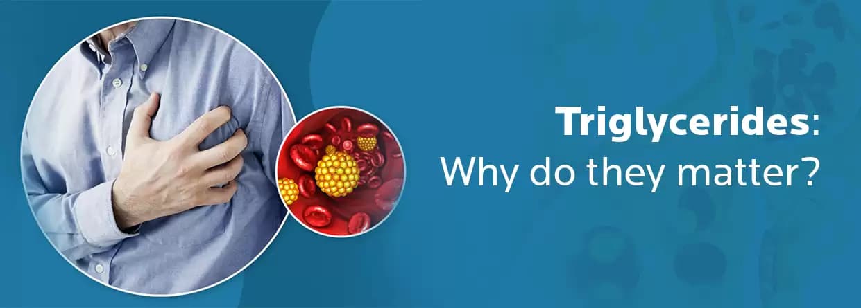 All You Should Know About Triglycerides