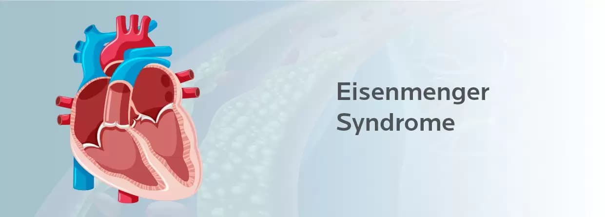 Eisenmenger Syndrome- Your Ultimate Guide