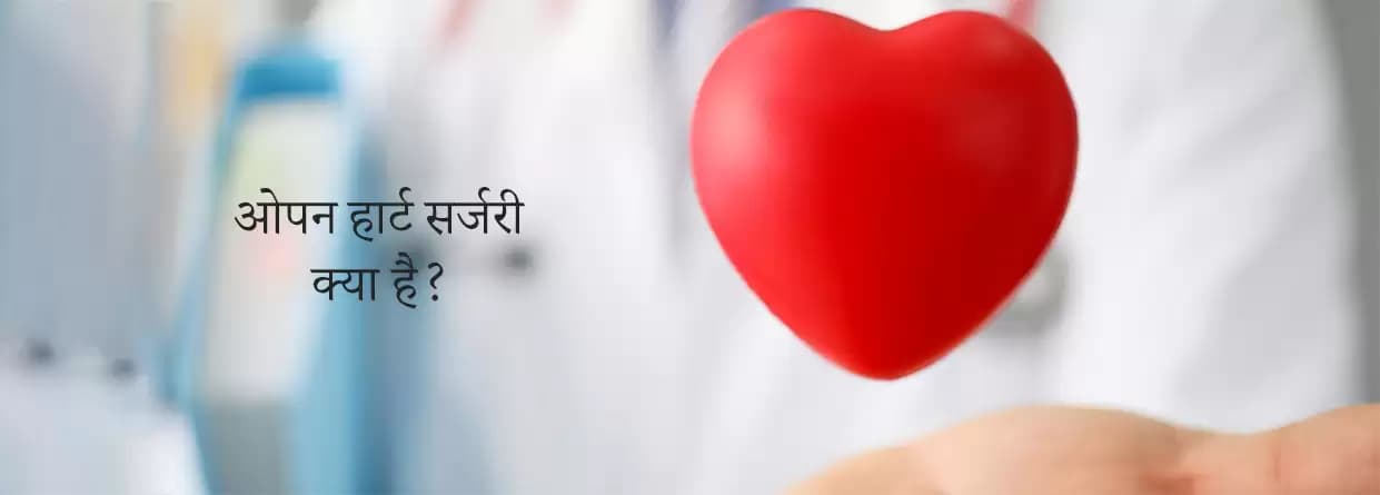ओपन हार्ट सर्जरी क्या है?