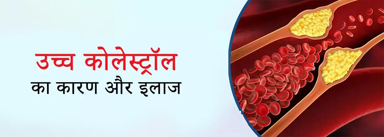 उच्च कोलेस्ट्रॉल का कारण और इलाज