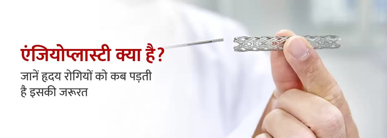 एंजियोप्लास्टी क्या है और क्यों पड़ती है इसकी जरूरत