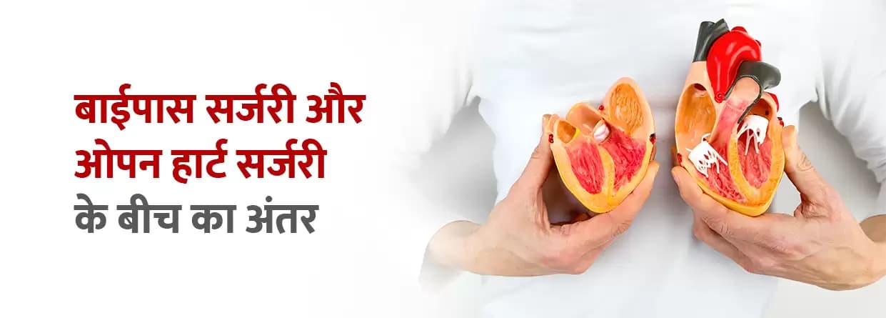 ओपन हार्ट सर्जरी और बाईपास सर्जरी के बीच क्या अंतर है?