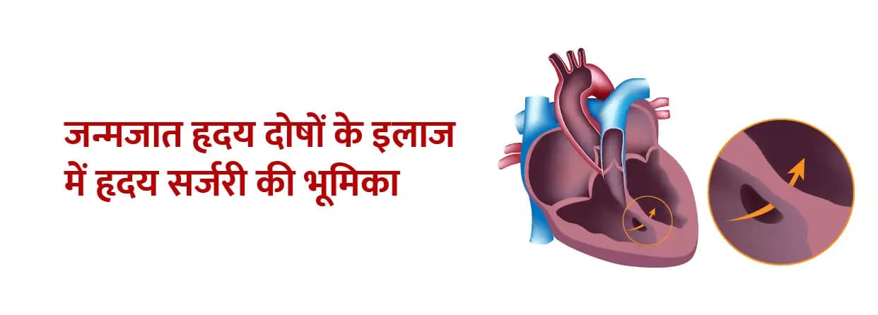 जन्मजात हृदय दोषों के इलाज में हृदय सर्जरी की भूमिका