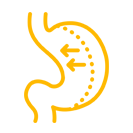 Radical Gastrectomy
