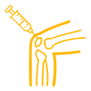 Injections of Steroid into Joint