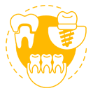 Oral Implantology
