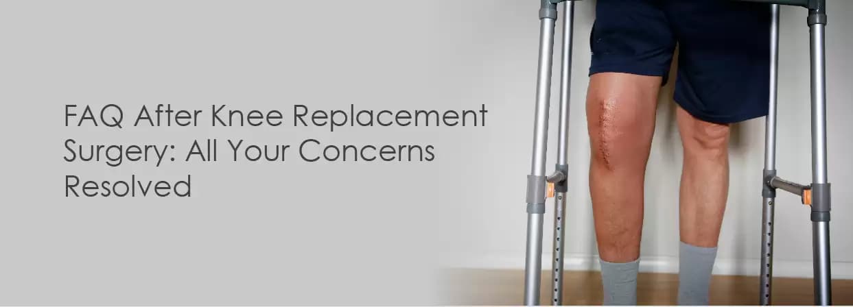 FAQ After Knee Replacement Surgery: All Your Concerns Resolved