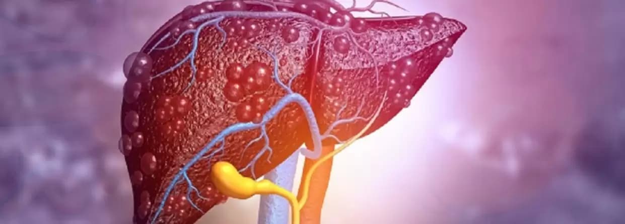 An ultimate guide on Liver Transplant