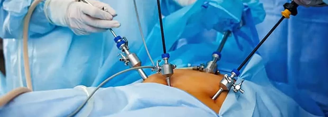 Understanding Laser Stone Operations: Types of Rays Used