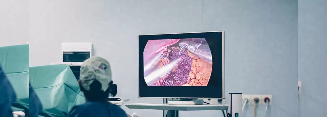 Nuances of Bariatric Surgery