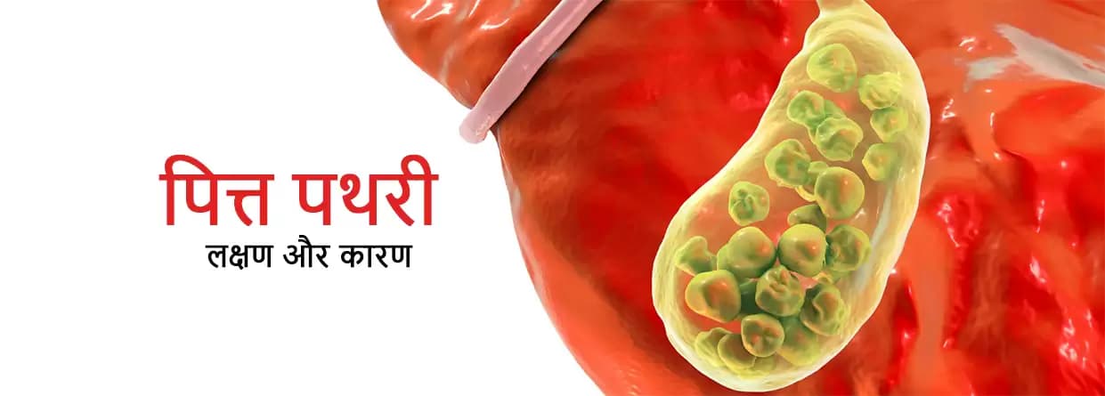 पित्त पथरी - लक्षण और कारण