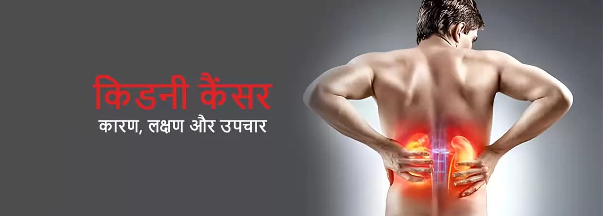 किडनी कैंसर के शुरुआती लक्षणों को कैसे पहचानें?