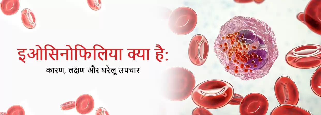 इओसिनोफिलिया क्या है? – कारण, लक्षण और घरेलू उपचार