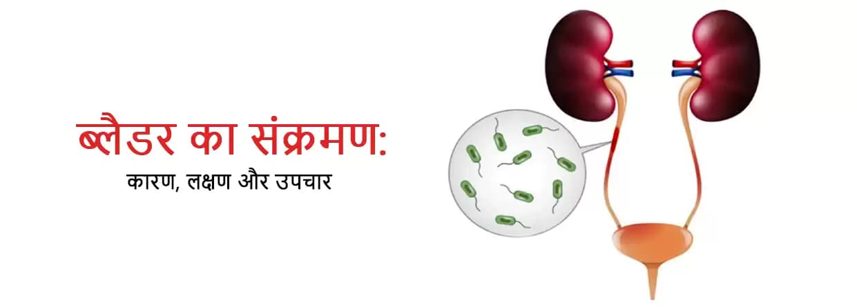 ब्लैडर का संक्रमण: कारण, लक्षण और उपचार