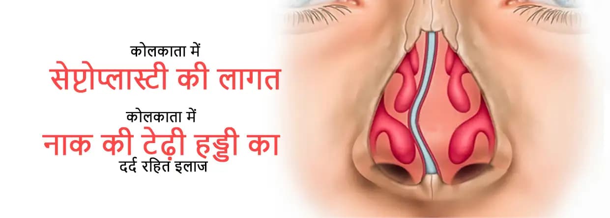 कोलकाता में सेप्टोप्लास्टी की लागत
