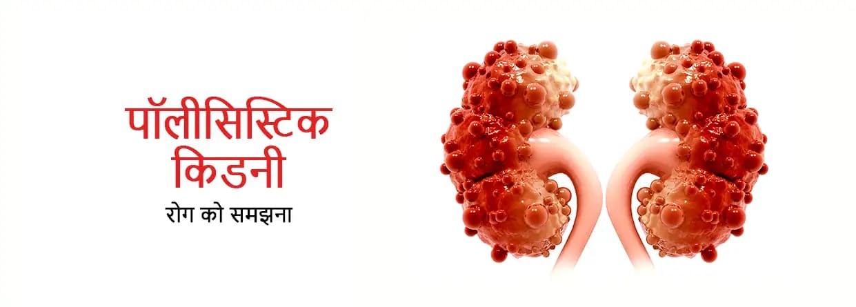 पॉलीसिस्टिक किडनी रोग को समझना